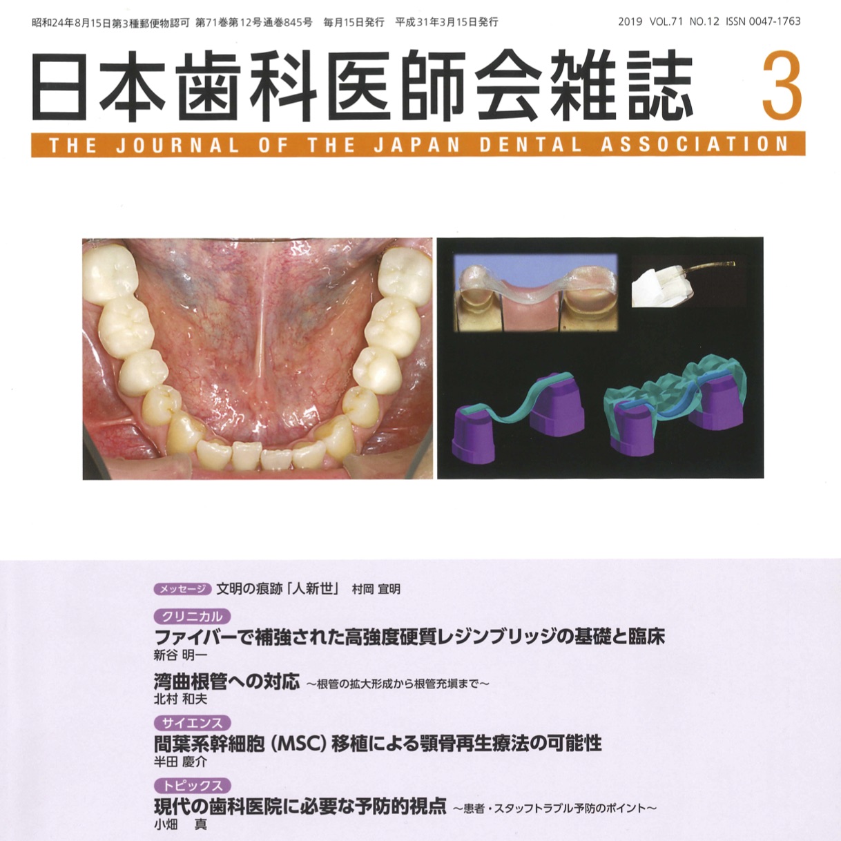 日本歯科医師会雑誌 第71巻 第12号（2019.3号）に寄稿論文が掲載されました。